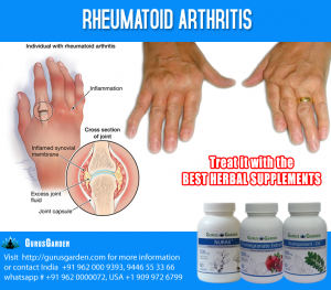 Herbal Supplements for Rheumatoid Arthritis